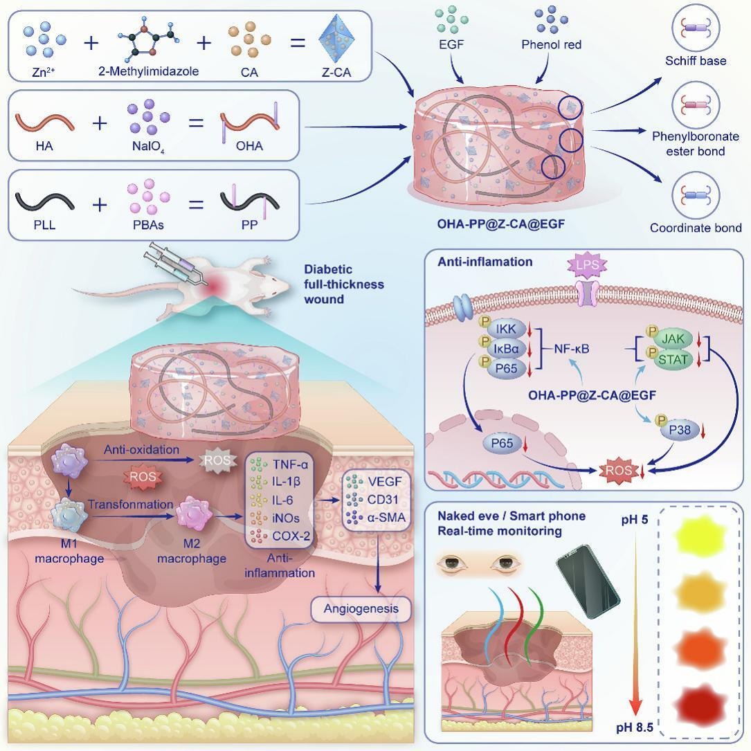 Modulating macrophage phenotype for accelerated wound healing with chlorogenic acid-loaded nanocomposite hydrogel.
| Mingji Jin, Peking Union Medical College |
[50 days' free access]
#hydrogel #macrophage #Woundhealing
authors.elsevier.com/a/1itNHcI2-5wcD