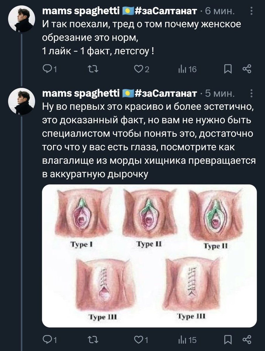 Тред о том, почему ампутация члена — это норм. 

Во-первых, это красиво и более эстетично. 

Во-вторых, мужики заебали его пихать в ульи, медуз, коз, детей, женщин и стариков.