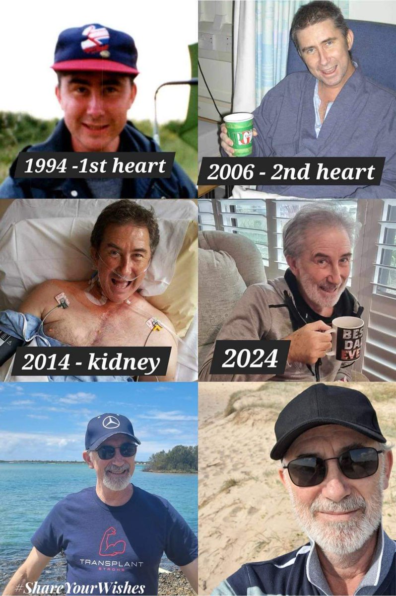 “30 additional years thanks to my donors and their families.” 30 years ago today Andrew received a #HeartTransplant. Since then he has required a further heart transplant and a #KidneyTransplant. Andrew shares his story ❤️ facebook.com/share/p/1Dmn4C…