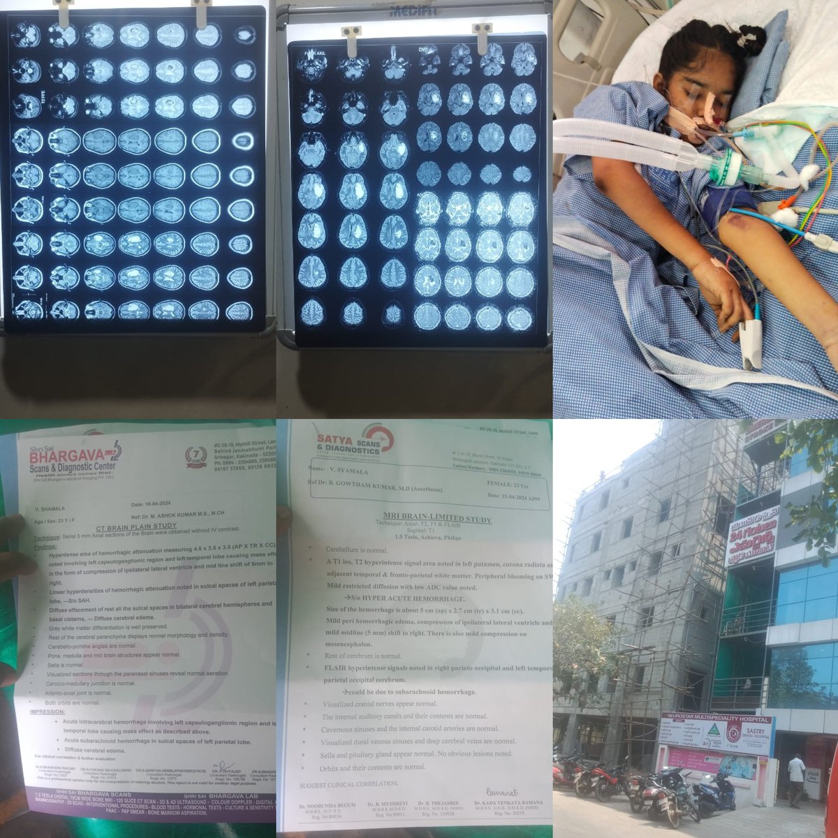 VDTrendsOffl's tweet photo. V. Syamala (23) is suffering from brain injury and is receiving treatment at Satya Neuromulti Speciality Hospital. To continue her treatment and expedite her recovery, they are seeking financial help of 3 lakhs 

Contact No: 9705461575 (Durga Prasad) https://t.co/IrvsACpOFT