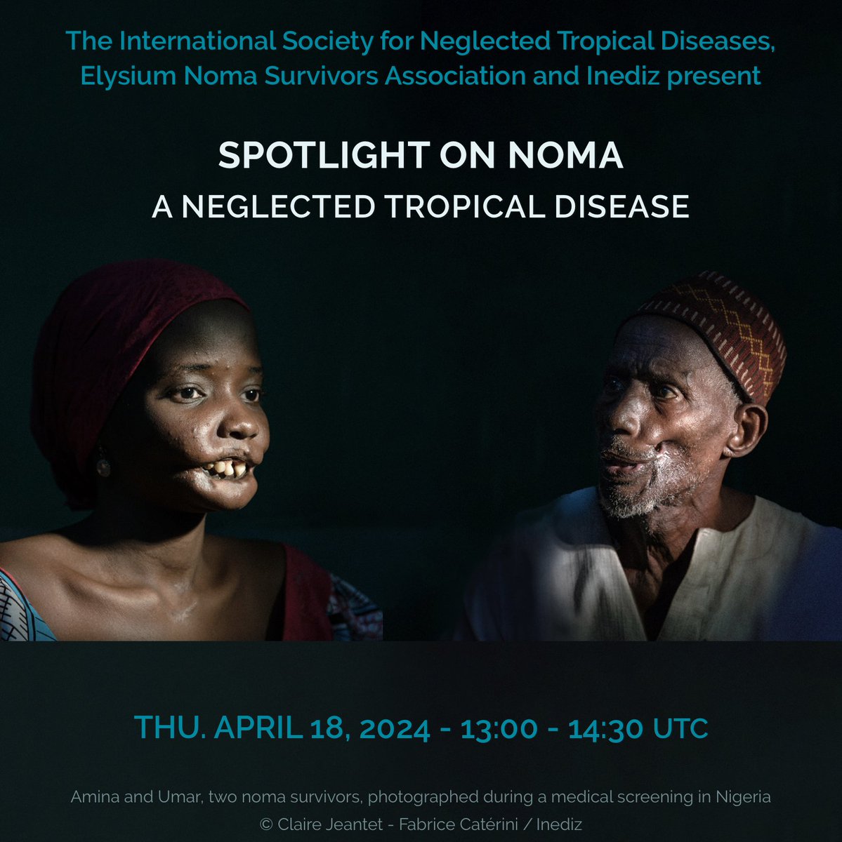 📢What is #noma & what next now that it is officially classed as a Neglected Tropical Disease? Please join @WHO, @Elysium_NSA, Dr Gebretsadik (@euclidint), Ms Elsig (Sentinelles), @Inediz & @ISNTD_Press! 👉tinyurl.com/SpotlightNoma 👉Apr 18 | 13:00 UTC #NeglectedNoMore