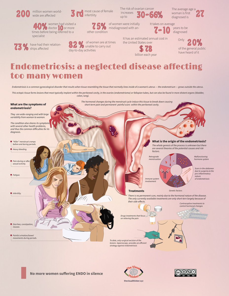 endometriosis @glogliiita #MedEd #MedX