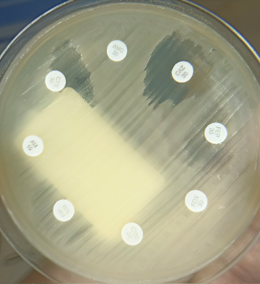 Fenotipo superpuesto en antibiograma de:

🦠 E. coli
🦠 Providencia stuartii

Tienes pistas para ver algo esperable, y algo menos esperable 👀

¿Qué ves?
