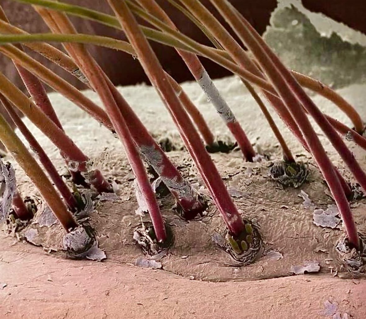 Good morning dear ladies & gentlemen! Close-up of human #eyelashes! This image depicts a colored scanning electron micrograph (SEM) of eyelash hairs emerging from the surface of human skin. Notice something peculiar at the base of the eyelashes? The tails of eyelash mites…