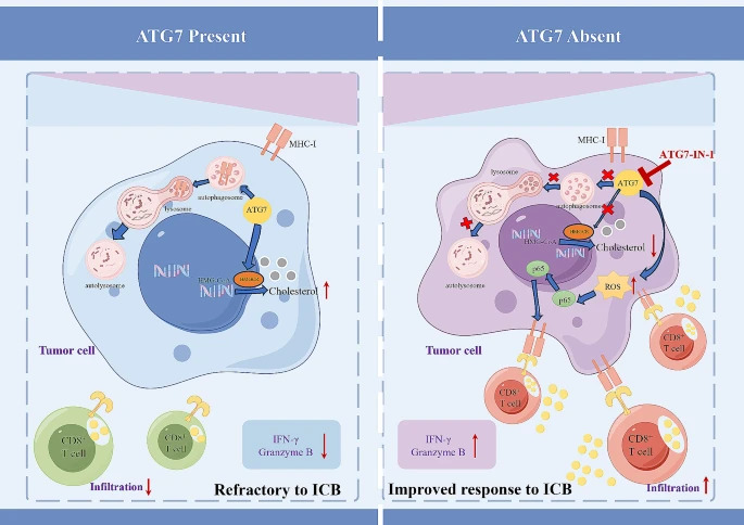 Online now!📲 Inhibition of #autophagy-related protein 7 enhances anti-tumor #immuneresponse and improves efficacy of #immunecheckpointblockade in microsatellite instability #colorectalcancer Full text👇 jeccr.biomedcentral.com/articles/10.11… #Cholesterol #Microsatelliteinstability