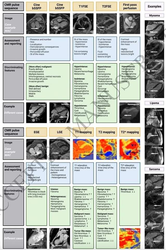 🔴 How to evaluate cardiac #masses by cardiovascular magnetic resonance parametric mapping? #openaccess #2023Review 

academic.oup.com/ehjcimaging/ad…
#CardioTwitter #CardioEd #WhyCMR