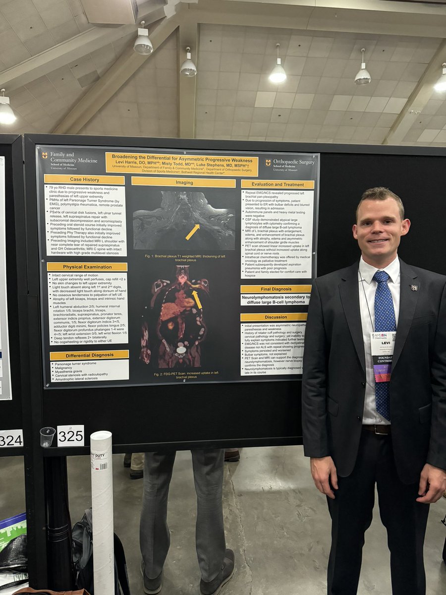 StephenSportsMD's tweet photo. Levi Harris and myself case poster #amssm24 @muhealth @MizzouOrtho @MizzouFamilyMed https://t.co/7jxy7699M5