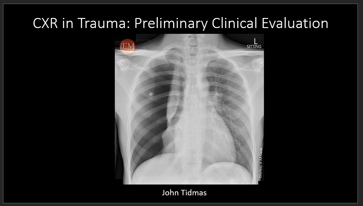 Very excited to be creating material for the new Preliminary Clinical Evaluation (Adult Chest) course @CCCU.  If anyone is interested, DM me for more info. Quick flavour of what I am up to, have a go at this #CXR (answer to follow).