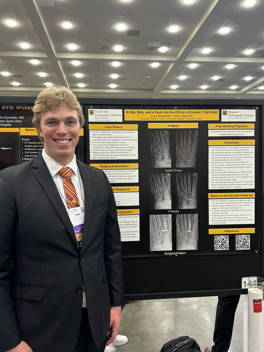 StephenSportsMD's tweet photo. Cody Weisel and Aaron Gray case poster #amssm24 @muhealth @MizzouOrtho @MizzouFamilyMed @MizzouSportsDoc https://t.co/vqNcNrzsKf