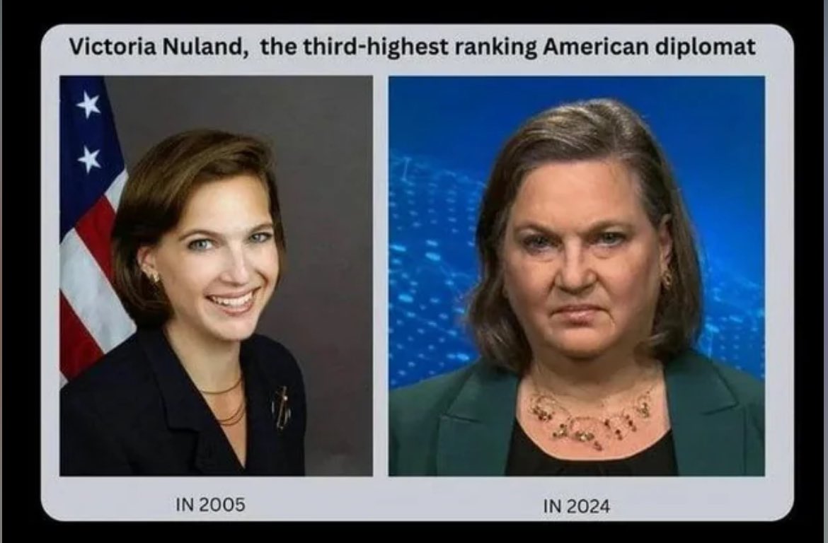 Victoria Nuland, the third highest ranking American diplomat, is a perfect example of what being a lifelong hate filled liberal does to your appearance 😂