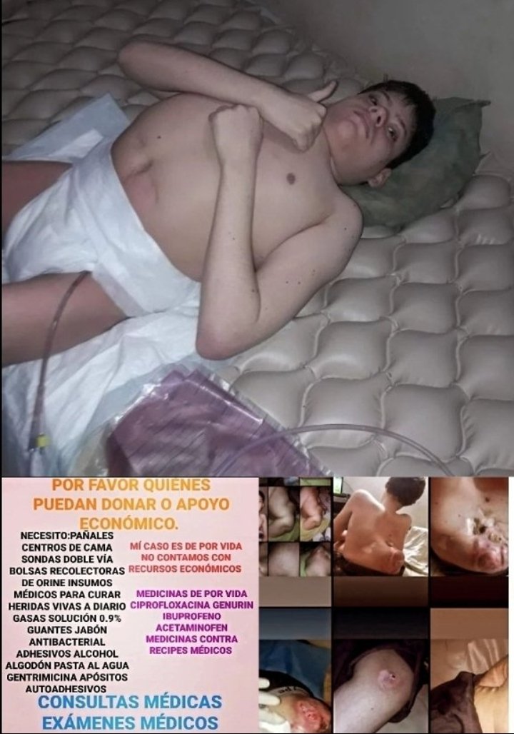 manuel02101's tweet photo. Necesito una silla especial neurológica foto referencial agradezco a fundaciones instituciones empresas privadas quienes puedan DONAR LA SILLA O APORTE PARA LA COMPRA @ManuelConecta @LuisOlavarrieta @nacholacriatura @manuelrosalesg @MariaCorinaYA @NicolasMaduro @ronaldacunajr24 https://t.co/iv1LZp12ES