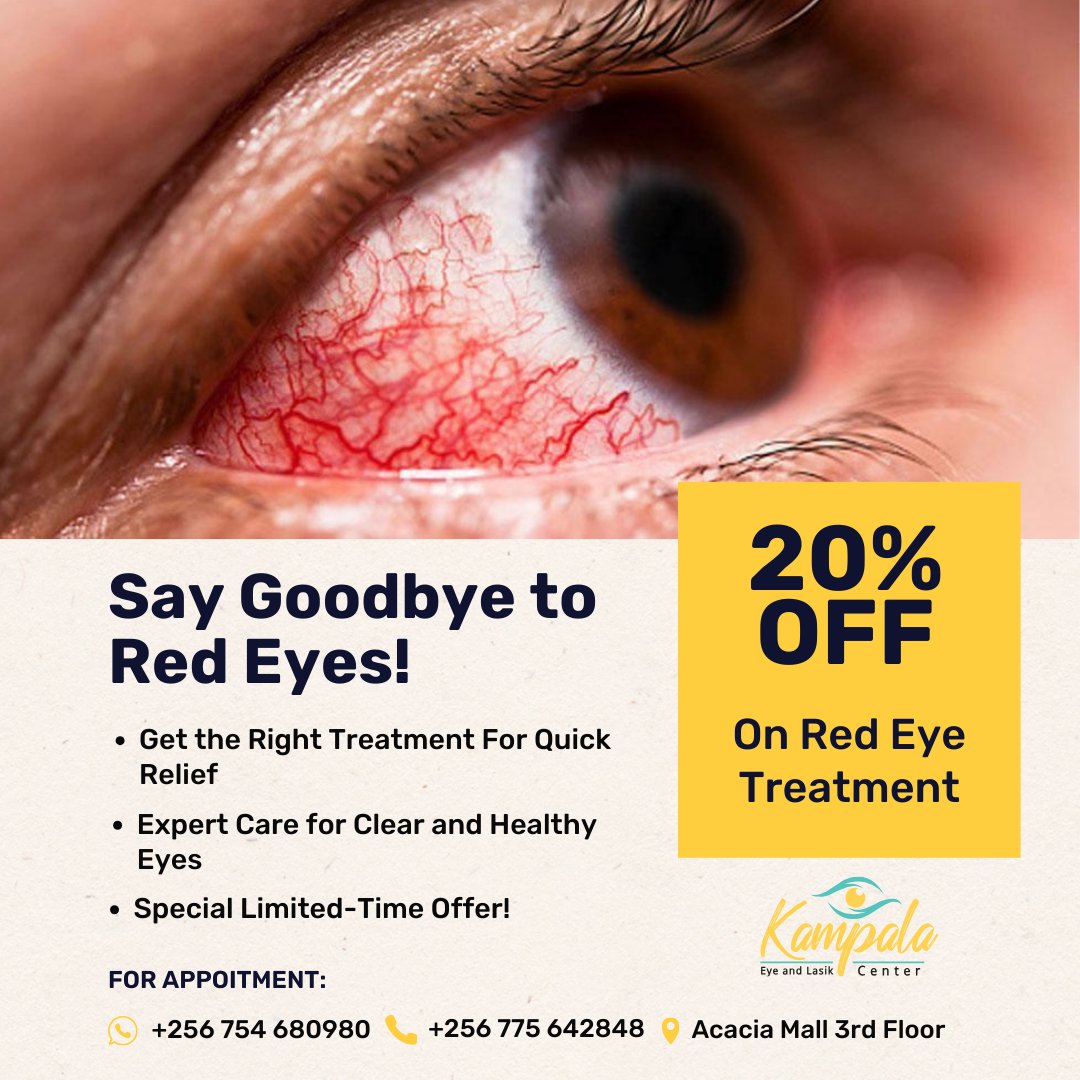 Say goodbye to red eyes! Get 20% Off Expert Treatment Today.

Amidst the recent red eye outbreak, Choosing professional care is crucial. Visit Our clinic today for effective treatment 

For Appointment.
👆🏾 wa.me/256754680980  
📞0754680980 
📌Acacia Mall 3rd Floor

#redeyes