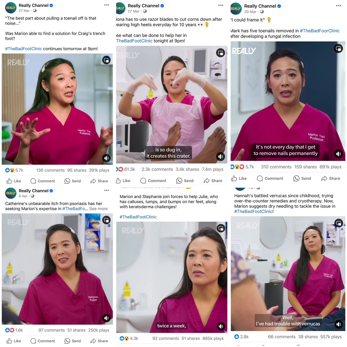 missfootfixer's tweet photo. Thank you guys for your overwhelming response even on the short clips from #TheBadFootClinicShow ❤️ https://t.co/IMLA4iSDGR
