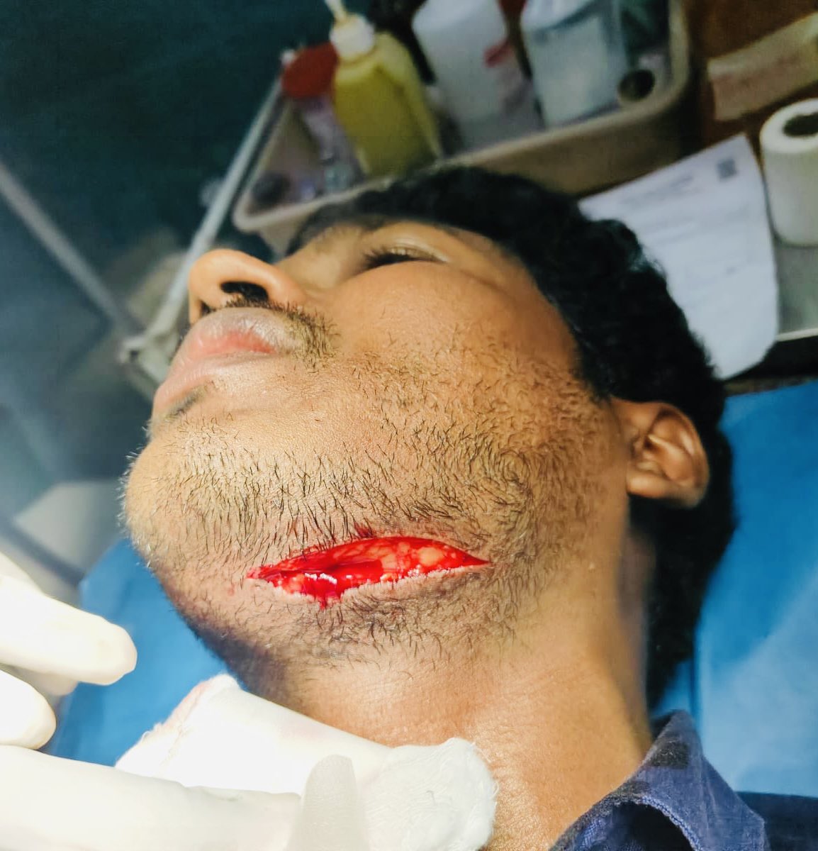 FordaIndia's tweet photo. Dear doctors of India, your neck is at stake. And quite literally so. 

Alleged case of an attack on doctor on duty in Puducherry hospital. 

All this election campaigning and NOT a single commitment on Safety for Doctors and their well being. 

The most educated but neglected community of this country, left to the dogs. 
@ANI @MoHFW_INDIA @HMOIndia @mansukhmandviya @AmitShah @PMOIndia
