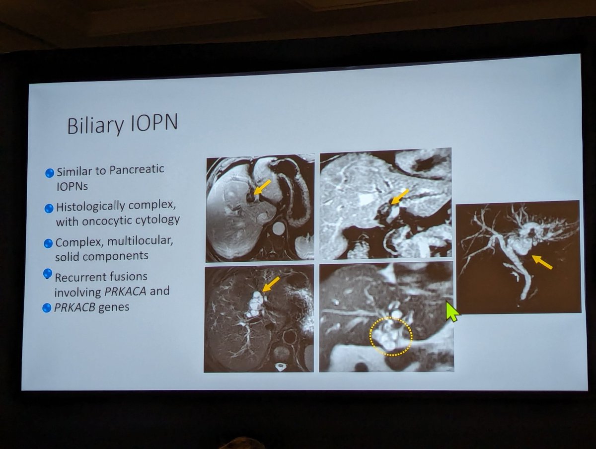 SAR Pancreatic Adenocarcinoma DFP (@sar_pancan_dfp) on Twitter photo Just a sample of the wonderful sessions this morning from an outstanding pancreaticobiliary plenary! #SAR24 <a href="/SAR_Pancan_DFP/">SAR Pancreatic Adenocarcinoma DFP</a> <a href="/SocietyAbdRad/">Society of Abdominal Radiology | SAR</a> Just a sample of the wonderful sessions this morning from an outstanding pancreaticobiliary plenary! #SAR24 <a href="/SAR_Pancan_DFP/">SAR Pancreatic Adenocarcinoma DFP</a> <a href="/SocietyAbdRad/">Society of Abdominal Radiology | SAR</a>