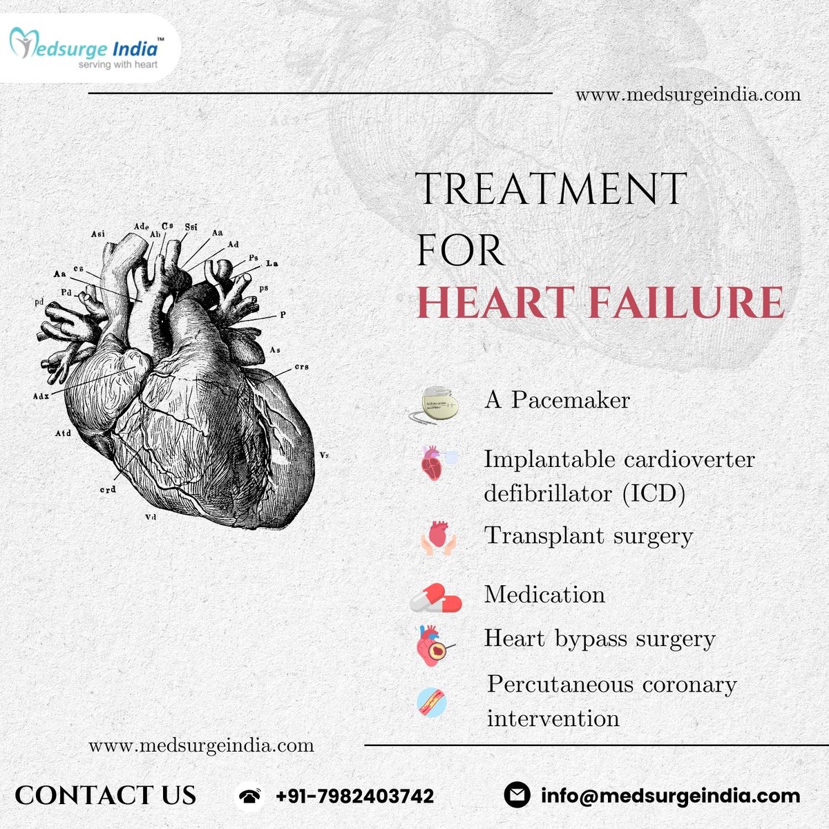 💔#heartfailure is a serious illness that has to be treated. Your chances of long-term recovery with fewer problems rise with early #treatment. Click - rb.gy/x2ceav #HeartHealth #heartbeat #heartfailure #cardiacarrest #cardiaccare #health #healthcare #medsurgeindia
