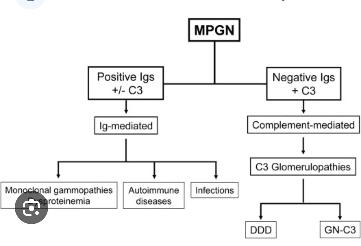 JasmineNephro's tweet photo. 🤔How can we differentiate between C3 Glomerulonephritis and dense deposit disease

🤷‍♀️Both are due to alternate complement pathway defect

✅DDD more common in children, C3GN adults

✅EM 🔬shows sausage shape dense intramembranous deposits in DDD and not in C3GN 

🆕🤩ApoE-Present in DDD and absent in C3GN 

#ISNWCN @SethiRenalPath 

🤩Go through next week @NephJC to know more