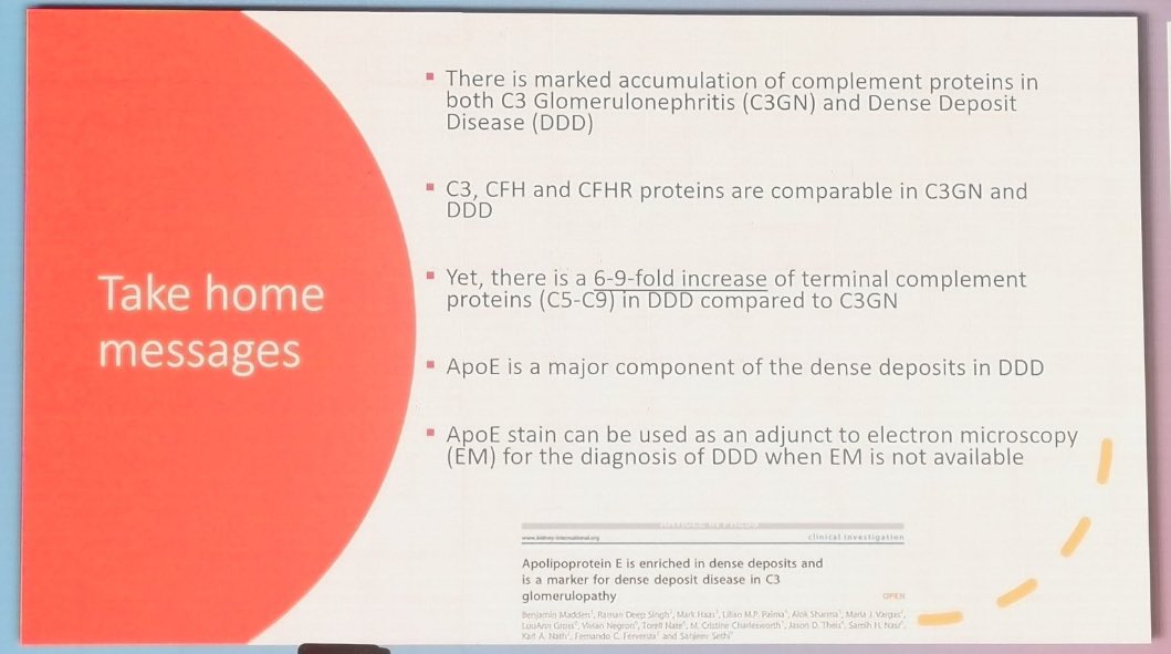 JasmineNephro's tweet photo. 🤔How can we differentiate between C3 Glomerulonephritis and dense deposit disease

🤷‍♀️Both are due to alternate complement pathway defect

✅DDD more common in children, C3GN adults

✅EM 🔬shows sausage shape dense intramembranous deposits in DDD and not in C3GN 

🆕🤩ApoE-Present in DDD and absent in C3GN 

#ISNWCN @SethiRenalPath 

🤩Go through next week @NephJC to know more