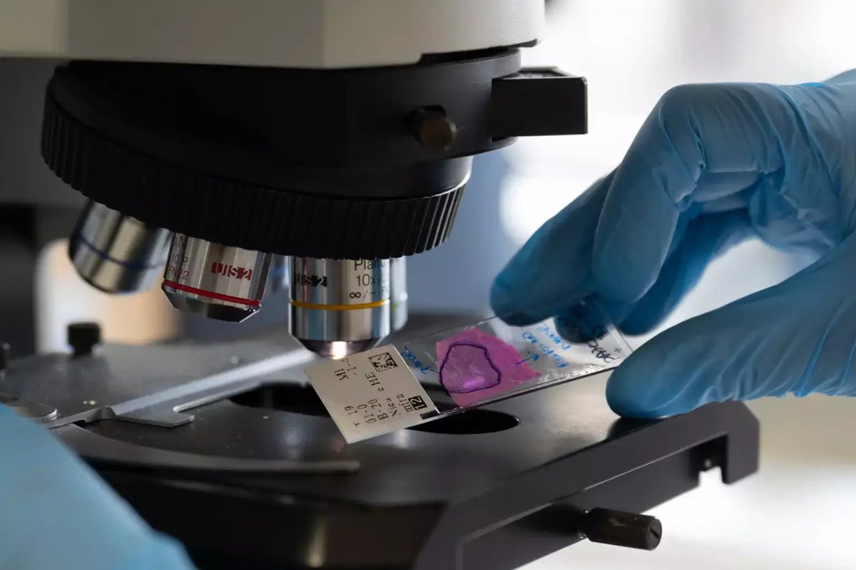 🆕 Adjudicats els Contractes de Recerca Avançada <a href="/FundacionBBVA/">Fundación BBVA</a> – Hospital #CLÍNIC Barcelona Joan Rodés – Josep Baselga

El projecte sobre #EsclerosiMúltiple latent d'Alberto Calvi del grup de <a href="/EmImagin/">ImaginEM</a> de l'IDIBAPS ha estat un dels seleccionats

👉 i.mtr.cool/zktwurlnmp