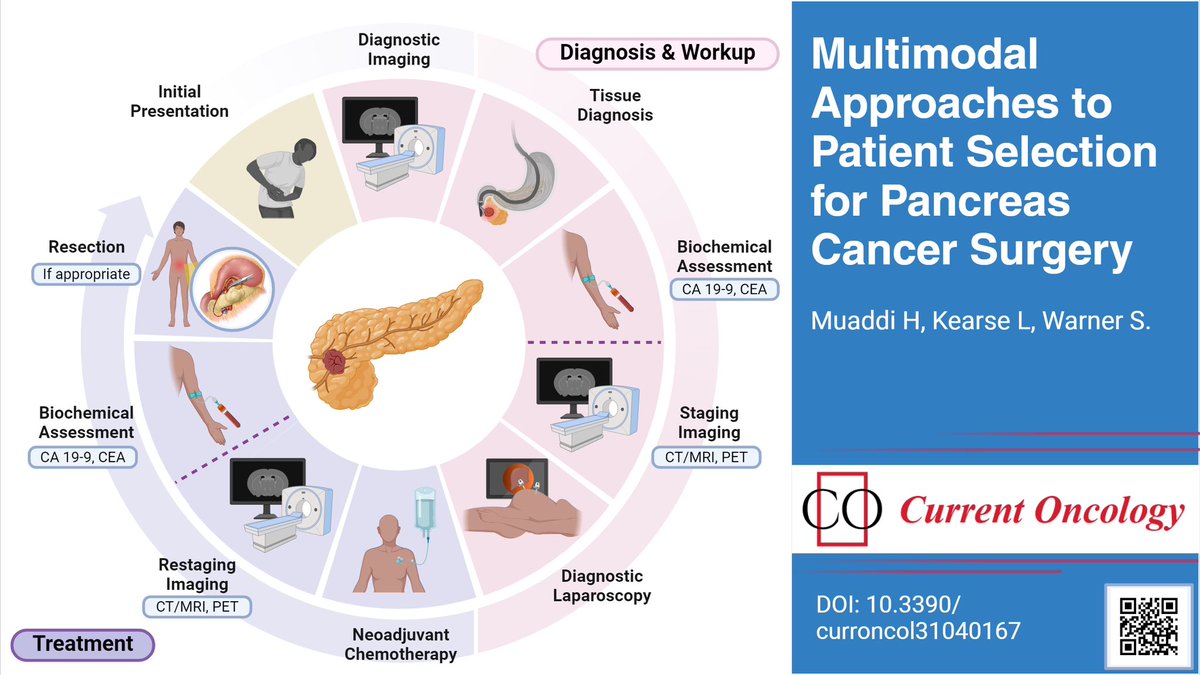 Excited to share our latest work on our standardized approaches to patient selection & treatment of PDAC and our guiding 3 Rs: responsivity, reconstructability, recoverability. @drsuswarner @HalaMuaddi @MayoClinic mdpi.com/2751826 #mdpicurroncol @CurrentOncology