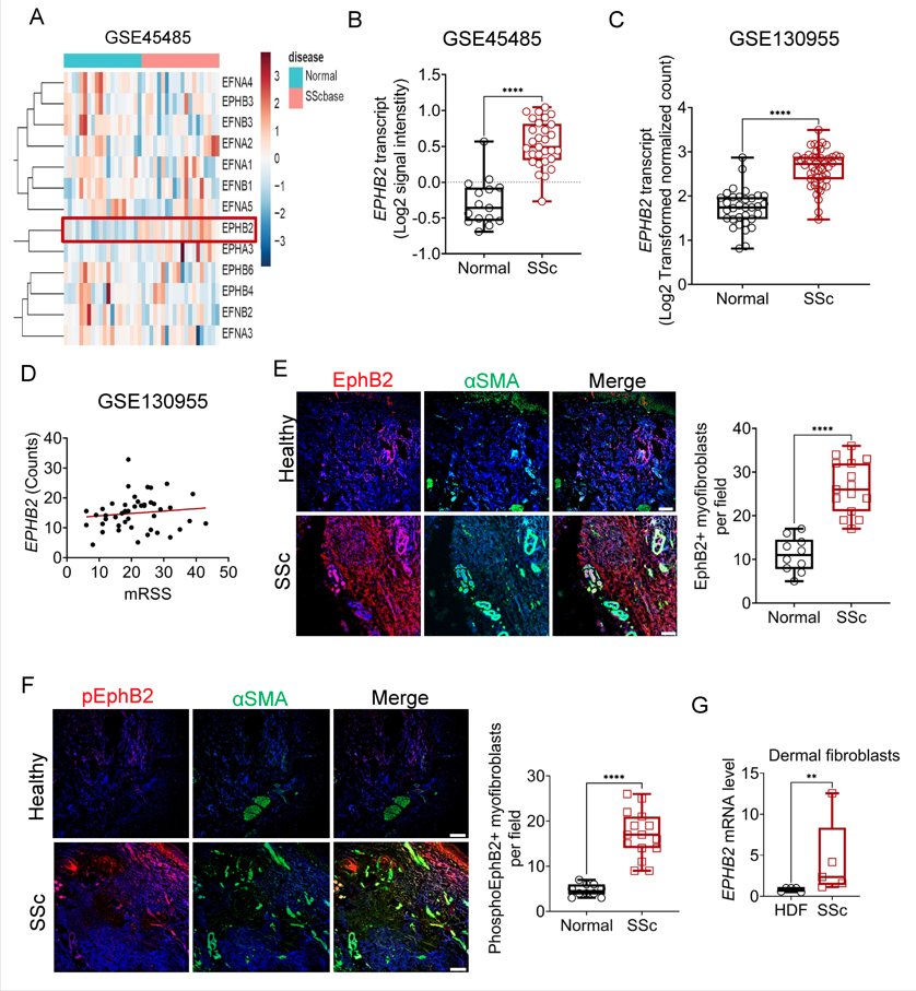 A novel role for EphB2 receptor tyrosine kinase in systemic sclerosis fibrogenesis In A&R loom.ly/FQ58be4 @MimcheLab Figure: EphB2 expression is upregulated in patients with SSc