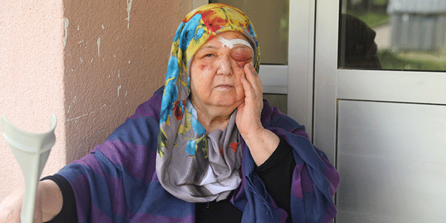 Başıboş köpeklerden kaçan 75 yaşındaki kadın yere düşünce yüzü bu hale geldi! #başıboşköpek 👇 yeniakit.com.tr/haber/basibos-…