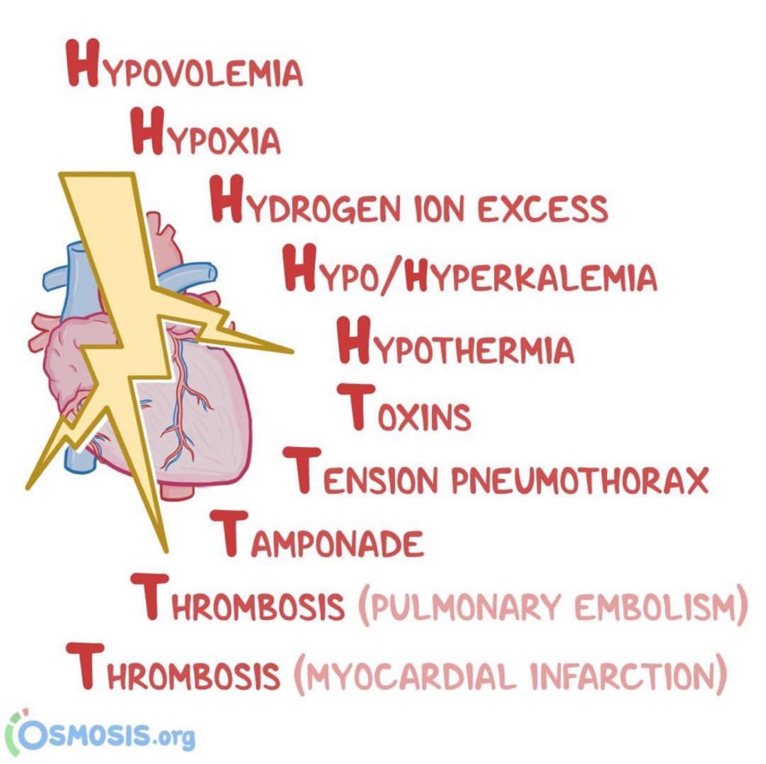 BrownJHM's tweet photo. H’s and T’s of ACLS @OsmosisMed #MedX https://t.co/DiSPgVYalO