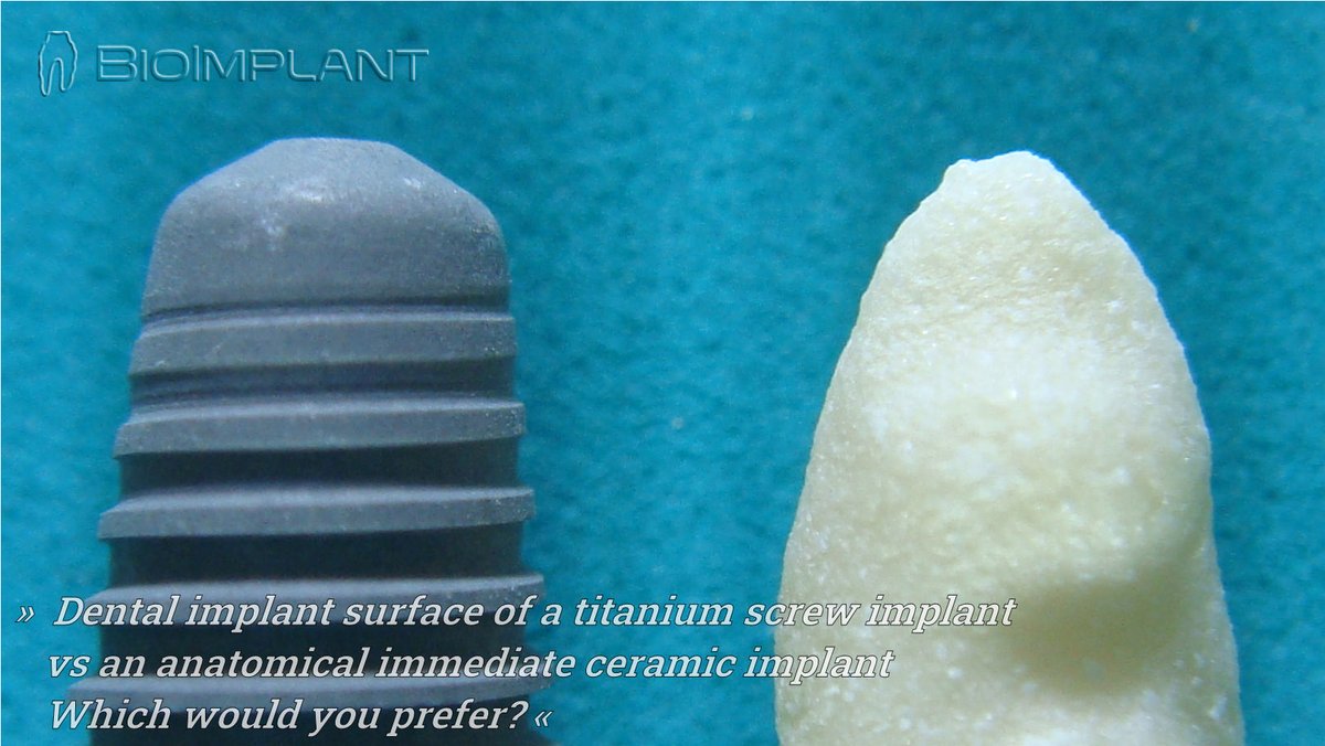 BioImplant (@bioimplant) on Twitter photo 