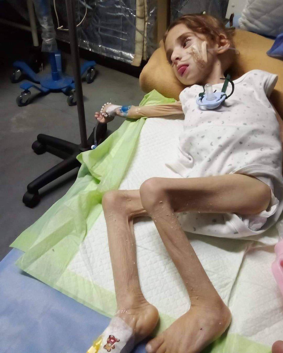 ⚠️Graphic content: Jannat Tareq Hamad, a child from Beit Hanoun, is suffering from internal bleeding and liver failure due to malnutrition. She is currently in the ICU at the Emirati field hospital and requires treatment abroad. As usual, the Egyptian regime prevents her from