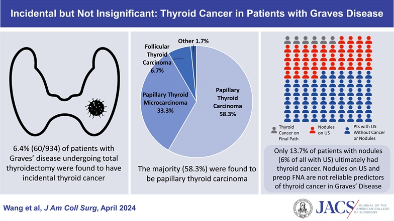 Incidence of thyroid cancer should not be underestimated when counseling patients on definitive management for Graves disease. journals.lww.com/journalacs/ful…