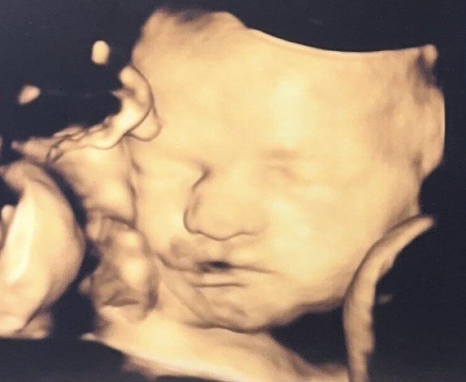 Uğur Karakullukçu tweet media