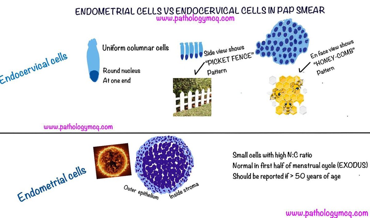 Differences between endometrial cells and Endocervical cells in PAP smear #PAPsmear #cervicalcytology #cytology #pathologymcq #pathologyresidents #pathologists #pathtwitter