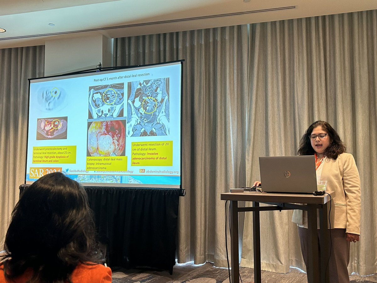 Linda Chu, MD (@lindachumd) on Twitter photo <a href="/HVadvala/">Harshna Vadvala, MD</a> and Dr. Rakhee Gawande showing amazing cases and teaching points for IBD associated malignancies. #SAR24 <a href="/HVadvala/">Harshna Vadvala, MD</a> and Dr. Rakhee Gawande showing amazing cases and teaching points for IBD associated malignancies. #SAR24