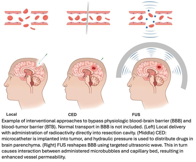 Future of Theranostics in Neurooncology Looks Promising With Recent Advancements 🧠 Learn more ➡️ bit.ly/3UQ7713 #RadOncEd #MachineLearning #BrainCancer #AI #HeadAndNeckCancer #OHANCAW #CancerAwareness