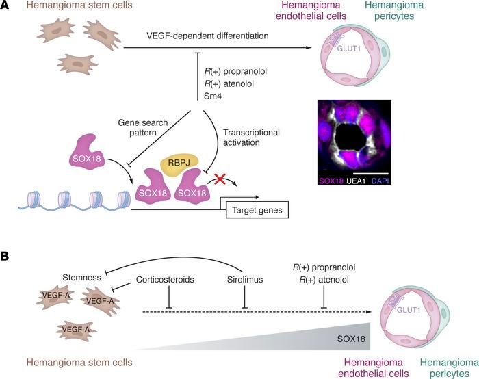 #ReviewSeries: Infantile hemangioma: the common and enigmatic vascular tumor: buff.ly/3Jm2Uvg @AnnegretHolm @BischoffJoyce @BostonChildrens @harvardmed