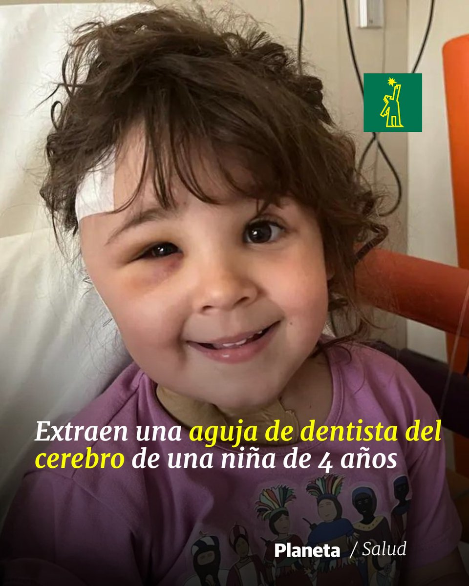 DiarioLibre's tweet photo. ⚕ |#SaludDL| El Hospital Sant Joan de Déu de Esplugues de Llobregat (Barcelona) ha conseguido extraer una aguja de dentista que una niña de cuatro años tenía clavada en el cerebro 

🔗https://t.co/B3S5wCVZyo

#DiarioLibre #OperaciónEspecial https://t.co/j8uVIVFDmy