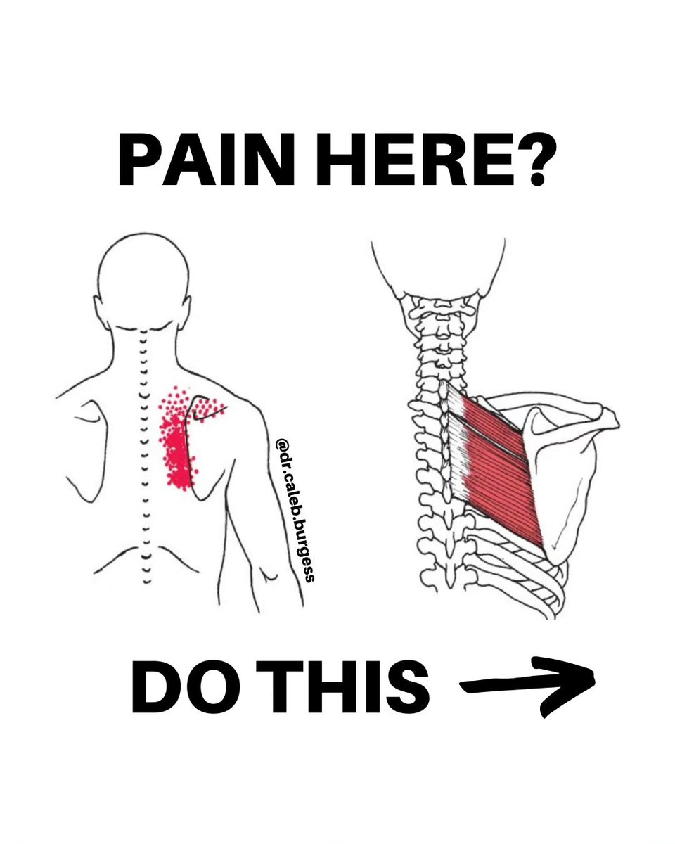 TheHealthLab's tweet image. Pain here?.... Do this
No gym.... Few equipments