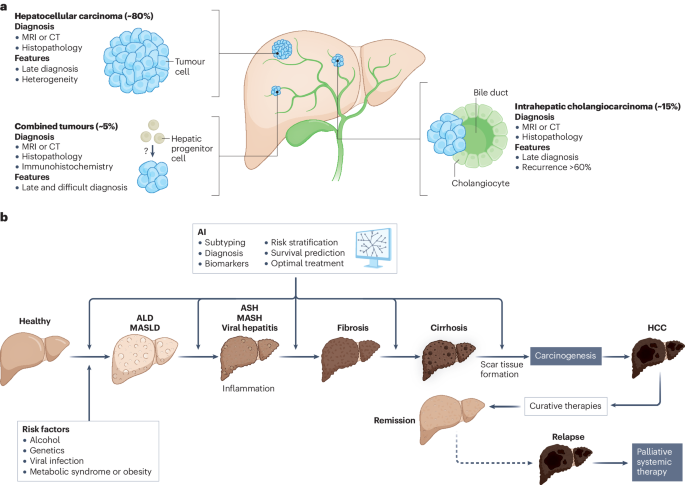 New content online: Artificial intelligence in liver cancer — new tools for research and patient management dlvr.it/T5b5cN