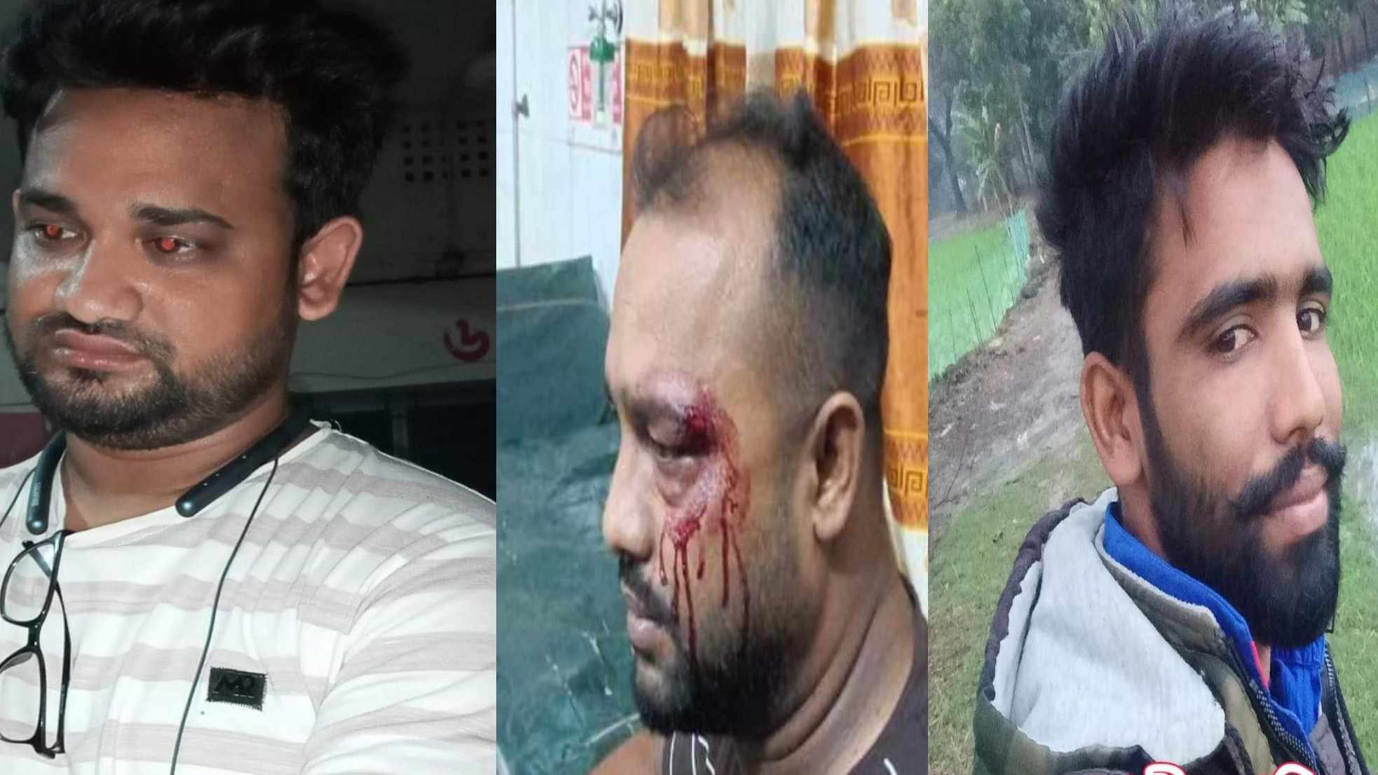 যশোরের শার্শায় সংবাদ প্রকাশের জেরে সাংবাদিকের উপর হামলা