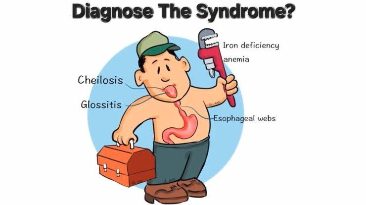 Diagnose the syndrome.
Hint: A plumber is at work
#MedTwitter #MedEd #MediaWatch