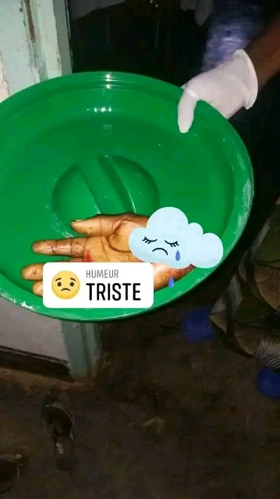 #GOMA_RDC  : On a coupé la main d'une femme avant de lui ravir l'argent qu'elle venait de retirer d'un Shop vers le quartier Mabanga sud ce 16/04/2024.

Tous les bandits et criminels de #Goma sont maintenant entrain d'opérer librement en profitant de la naïveté des autorités.