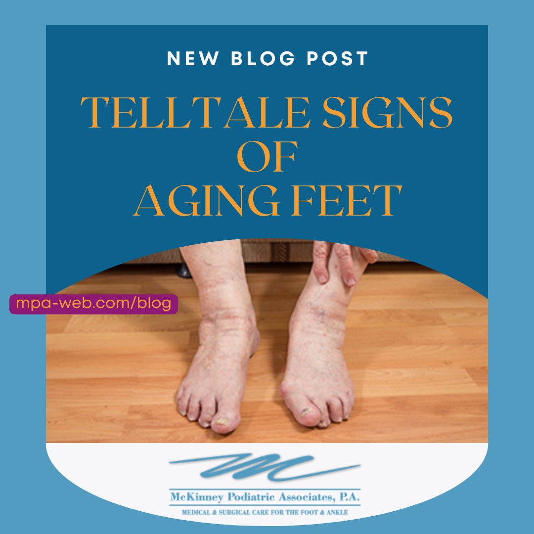 We don’t always think about the fact that our feet are aging right along with us! 

Check out our latest blog post:
mpa-web.com/blog

#blog #medicalblog #podiatryblog #footpain #elderlyfootcare #footcare #foot #bestpodiatrists #podiatrist #McKinneyPodiatricAssociates