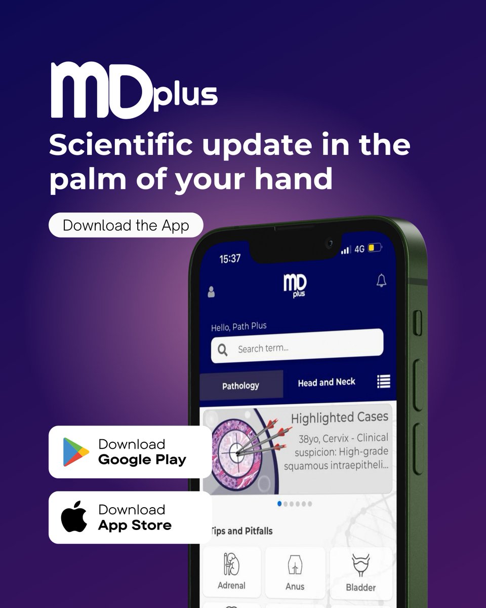 MDplusApp's tweet photo. MD Plus is the world's first pathology teaching app. A successful experience that is now expanded to other areas of medicine. The app has over 9,000 downloads from users in various countries around the world, such as Brazil, Argentina, Mexico, USA, Canada, India, and Pakistan. https://t.co/jYLaFWeLCT