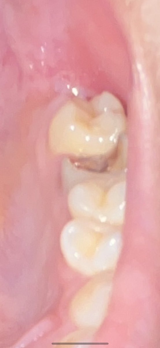 ついに歯医者の予約とってしまった、、🙀