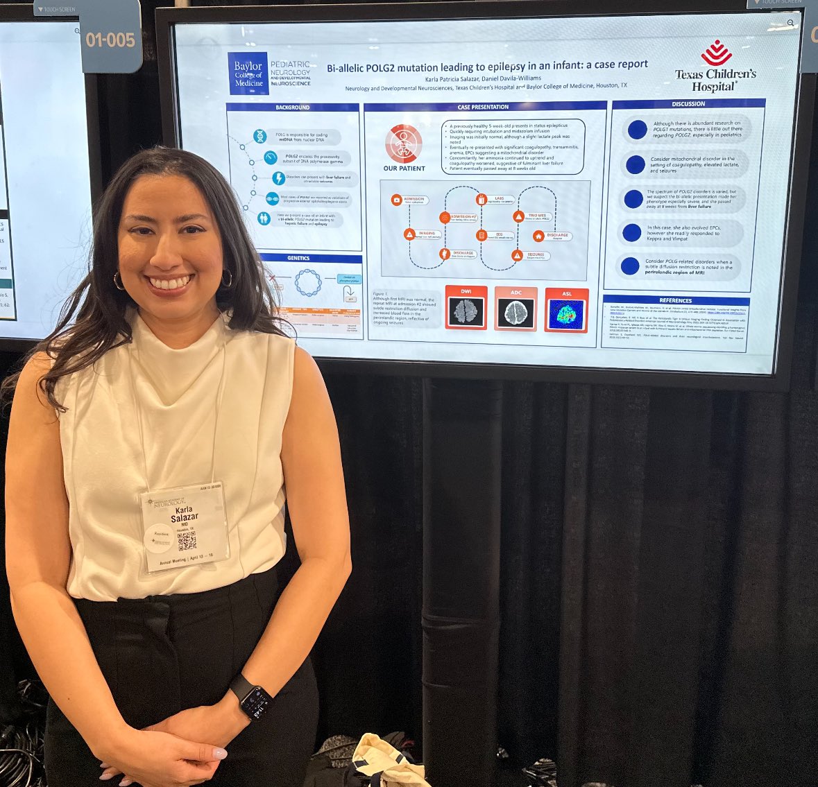 Karla Patricia Salazar, MD (@karlasalazarmd) on Twitter photo Stop by neighborhood 1, poster 4 and read about bi-allelic POLG2 presentation in an infant! <a href="/BCMChildNeuro/">BCM Child Neurology & NDD Residency</a> <a href="/DDavilaWilliams/">Daniel Davila-Williams</a> Stop by neighborhood 1, poster 4 and read about bi-allelic POLG2 presentation in an infant! <a href="/BCMChildNeuro/">BCM Child Neurology & NDD Residency</a> <a href="/DDavilaWilliams/">Daniel Davila-Williams</a>