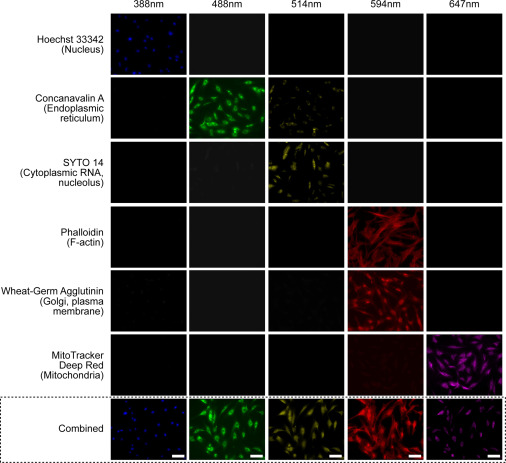 In this new study, deep learning algorithms are used to investigate the morphological effect of #gene knockouts in TM cells to identify #genetic regulators of IOP. #glaucoma #ophthalmology ow.ly/sBLU50QQ4qv