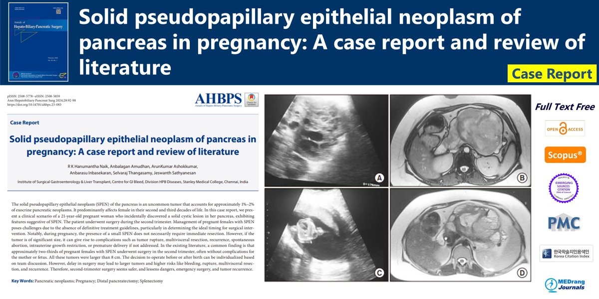 Solid pseudopapillary epithelial neoplasm of pancreas in pregnancy: A case report and review of literature 🌷doi.org/10.14701/ahbps… Ann Hepatobiliary Pancreat Surg 2024 Feb;28(1)R K Hanumantha Naik #Pancreatic_neoplasms #Pregnancy #Distal_pancreatectomy #Splenectomy
