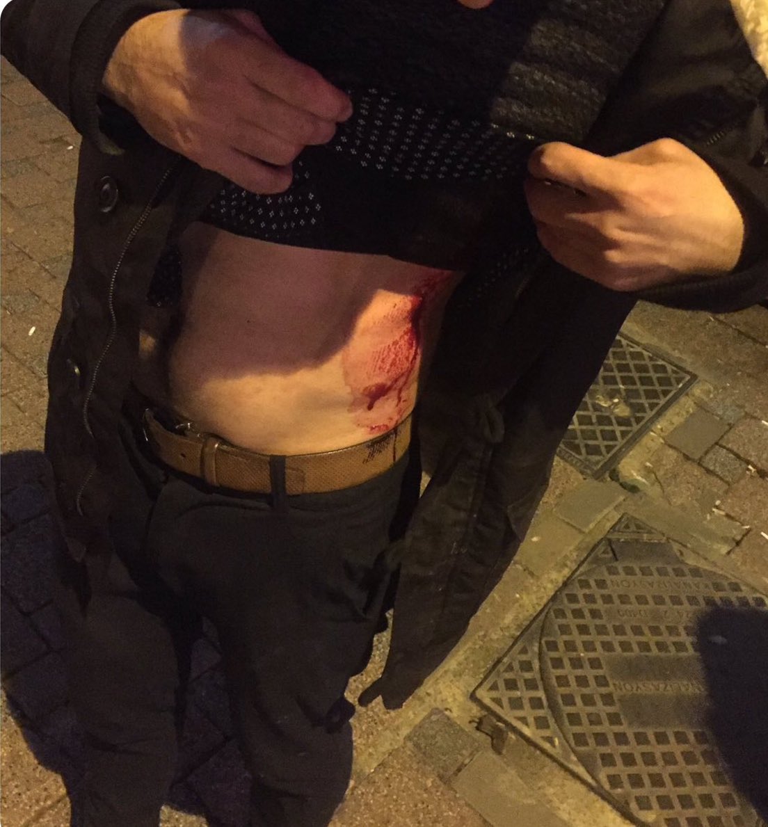 Az evvel kız arkadaşım tarafından bıçaklandım ama yine de onu çok seviyorum.