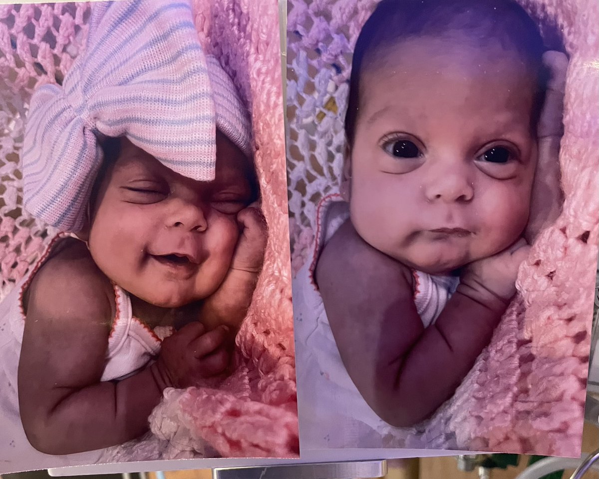 ZachWolchuk's tweet image. After 52 days in the NICU our baby girl is home! Can’t say enough about the staff at Medical City Plano! Eliza is happy & healthy ❤️