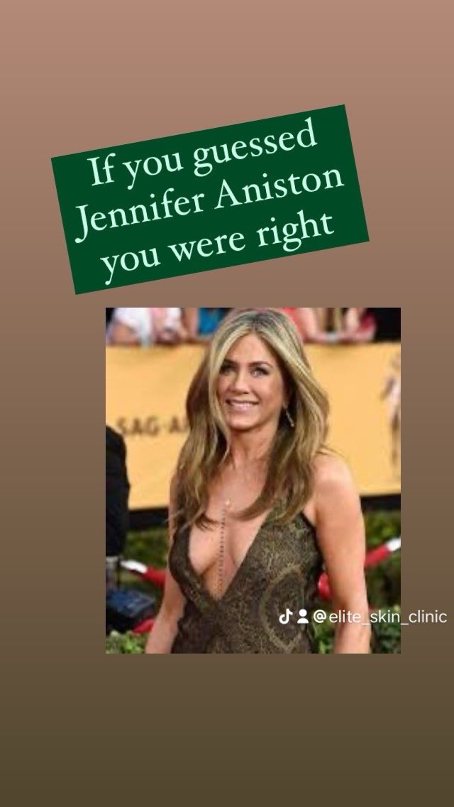 If you guessed Jennifer Aniston you were correct. The salmon sperm facial she referred to was polynucleotide treatment.

#polynucleotides #salmonspermfacial #jenniferaniston #refresh #brighteneyes #eyetreatment #puffyeyes #collagen #tuesday #cobhamskinclinic #cobham #surrey